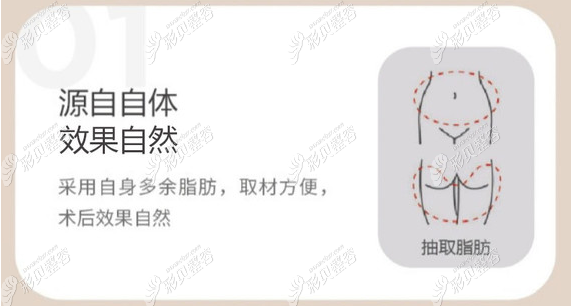 自体脂肪丰卧蚕