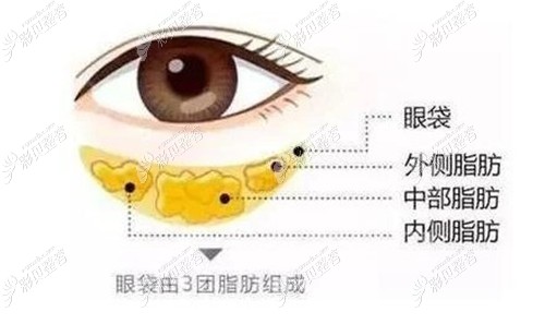 眼袋的脂肪图