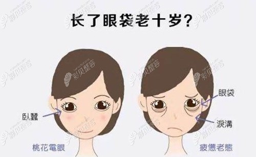 眼袋影响图