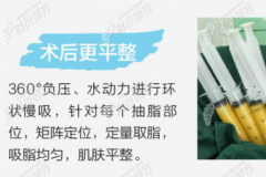 介绍山西整形外科医院刘晋元抽脂怎么样时提到了吸脂费用