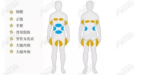 酷塑冷冻减脂的部位