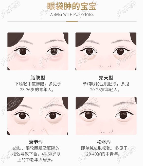 眼袋类型