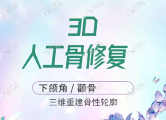 3d打印人工骨修复下颌角和颧骨优势
