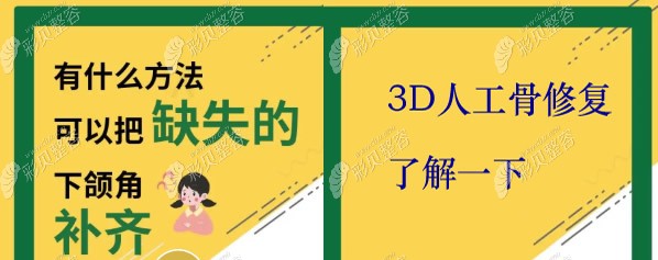 3D人工骨修复可以修复缺失的下颌角