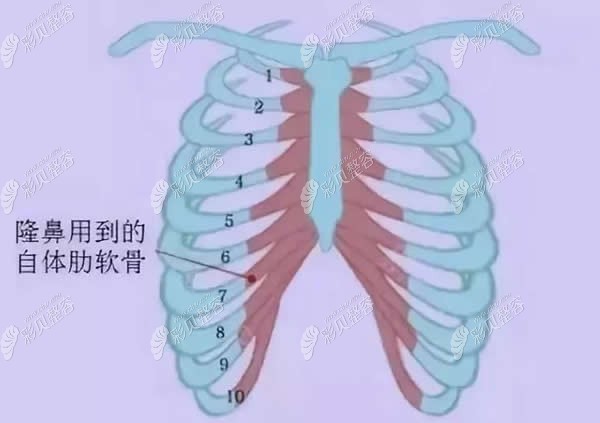 肋软骨隆鼻取肋部位图解