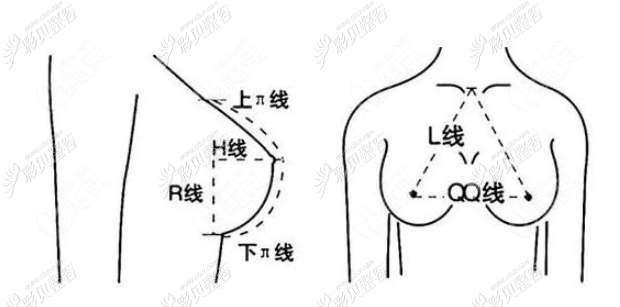假体隆胸数据判断 假体隆胸数据判断