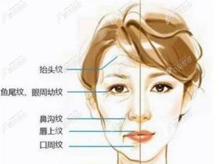 速拉美和V美减龄哪个好？区别有哪些