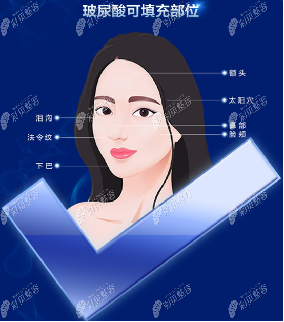 玻尿酸可以改善面部哪些问题