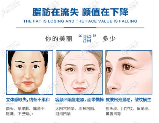 面部脂肪流失会造成哪些问题