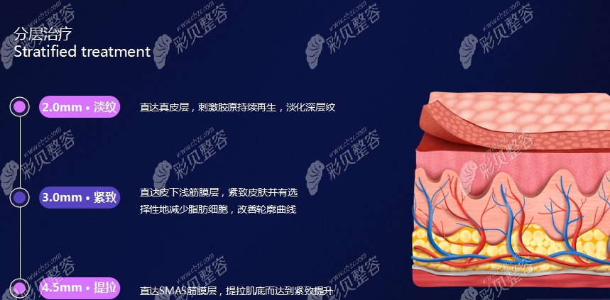 半岛超声炮治疗功效