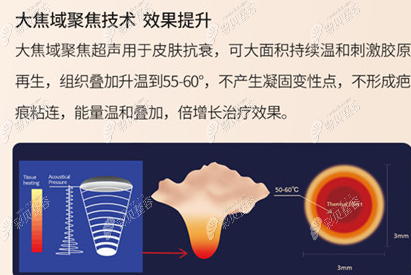 半岛超声炮抗衰作用原理