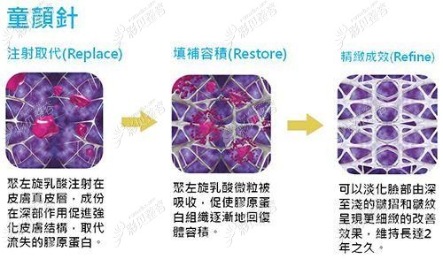 童颜针的作用原理