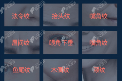深圳拉皮手术医生排行名单，面部大、小拉皮做得好的在这