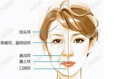 拉皮手术适应症