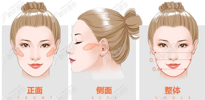 涨知识:颧骨内推手术适合多大年龄做?不超过30,50岁都可以做