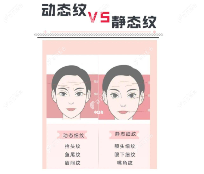 瑞蓝2号和瑞蓝定采适合的人群不一样