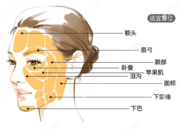 自体脂肪能填充的部位