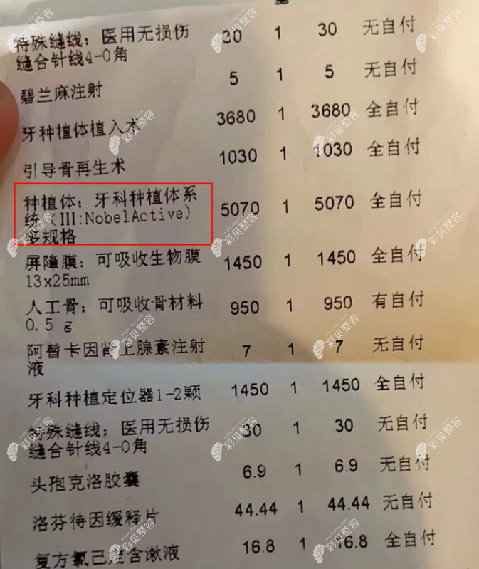 口腔医院种植牙价格中一些琐碎的费用 口腔医院种植牙价格中一些琐碎的费用