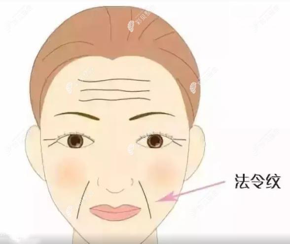 法令纹位置图解 法令纹位置图解