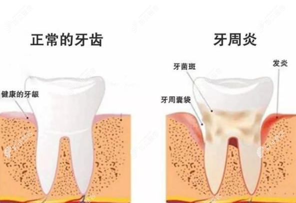 刘晨医生治疗口腔牙周炎经验比较丰富