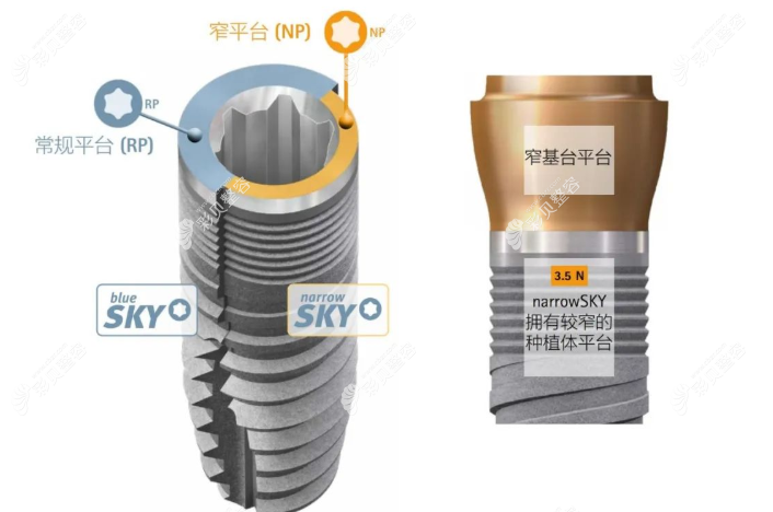 德国SKY种植体外观图谱
