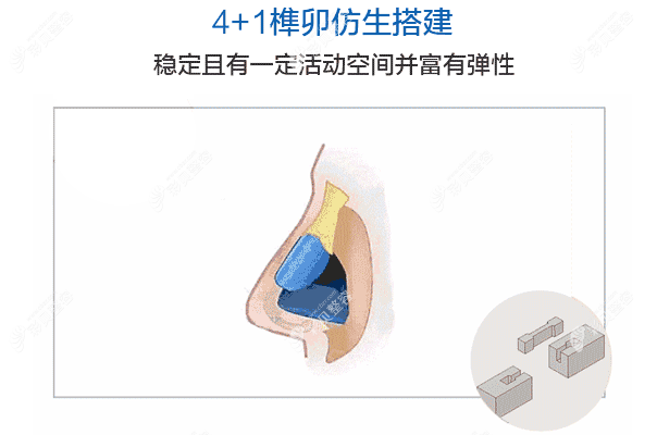 鼻梁结构