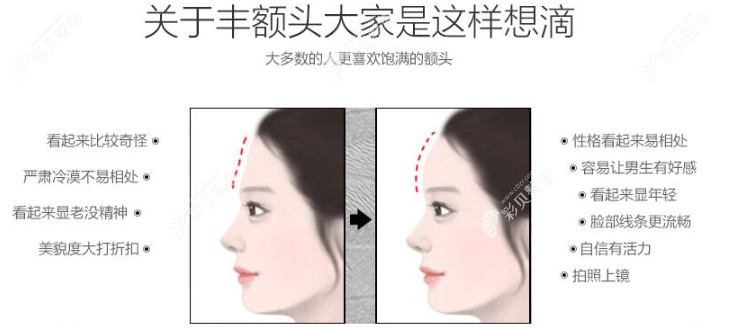 丰额头前后面部对比 丰额头前后面部对比
