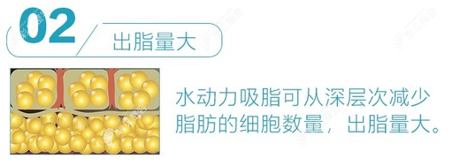 水动力吸脂