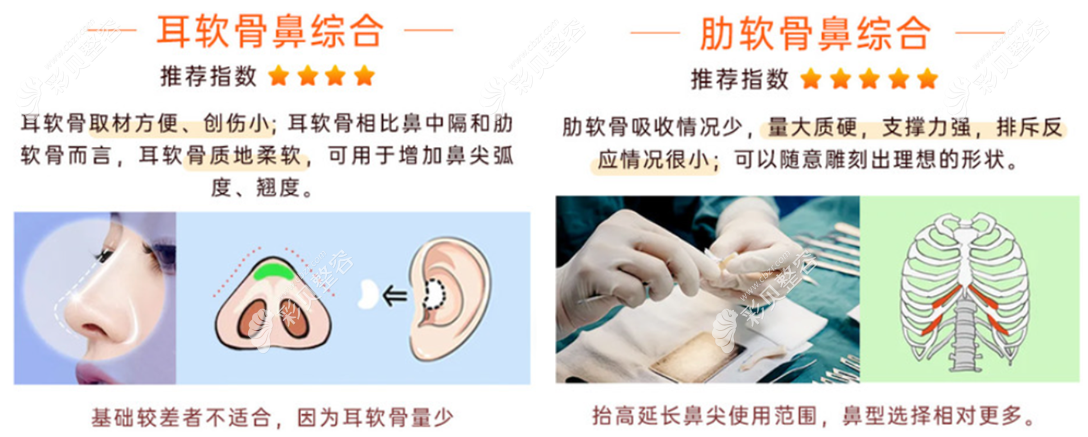 耳软骨鼻综合和肋软骨鼻综合对比