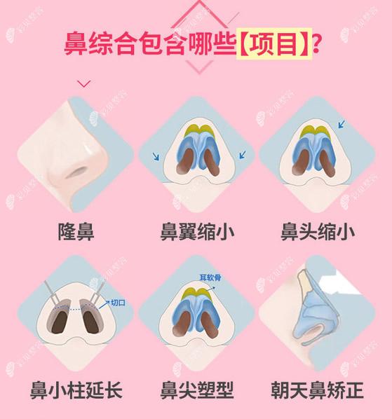 鼻综合包含哪些项目 鼻综合包含哪些项目