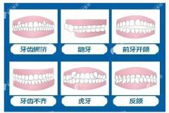 广州广大口腔医院正畸费用中,隐形比金属牙齿矫正价格贵