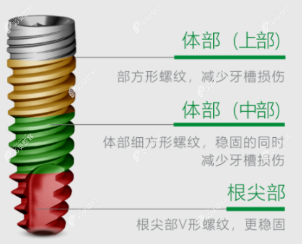 德国卡瓦abt种植体外观优势 德国卡瓦abt种植体外观优势