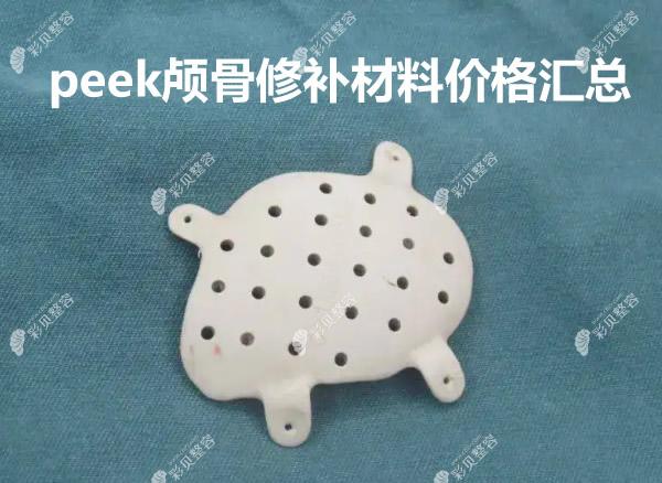 peek颅骨修补材料价格:含peek修复颧骨下颌角/额头/后脑勺费用