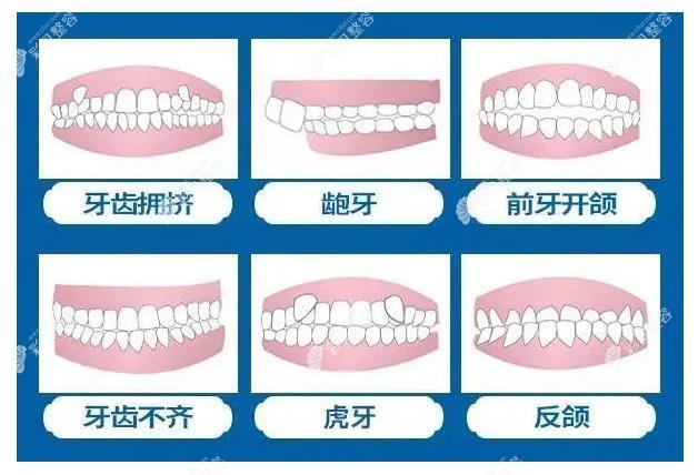 武汉中翰整形姚兴医生做牙齿矫正好吗