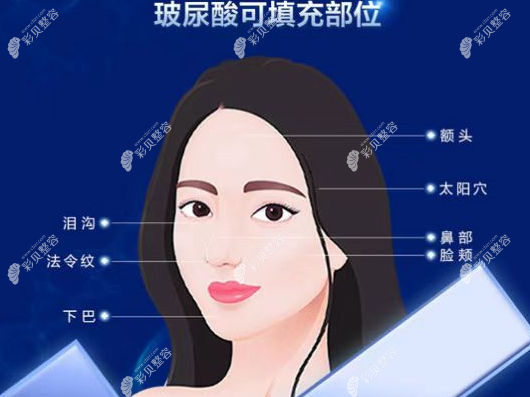 烟台口碑好的非手术隆鼻医院在哪,看烟台注射隆鼻医院名单