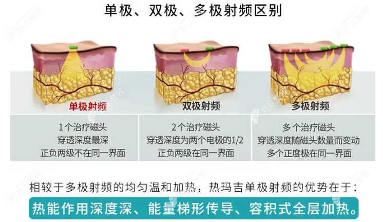 30岁做热玛吉早吗www.cbzr.com