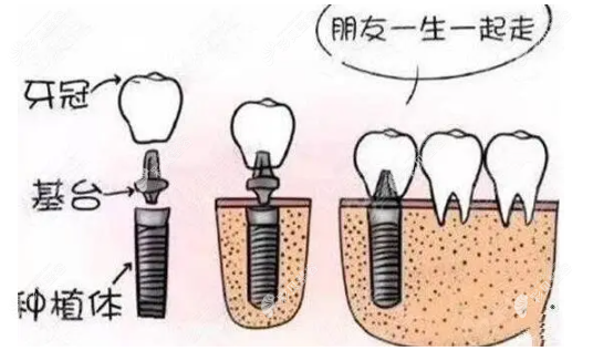 2022上海牙科收费标准