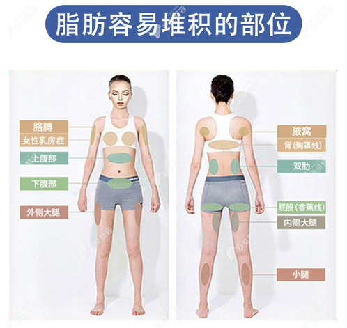 邢台吸脂医院推荐哪家,邢台博爱/伊美做大腿/腰腹抽脂好