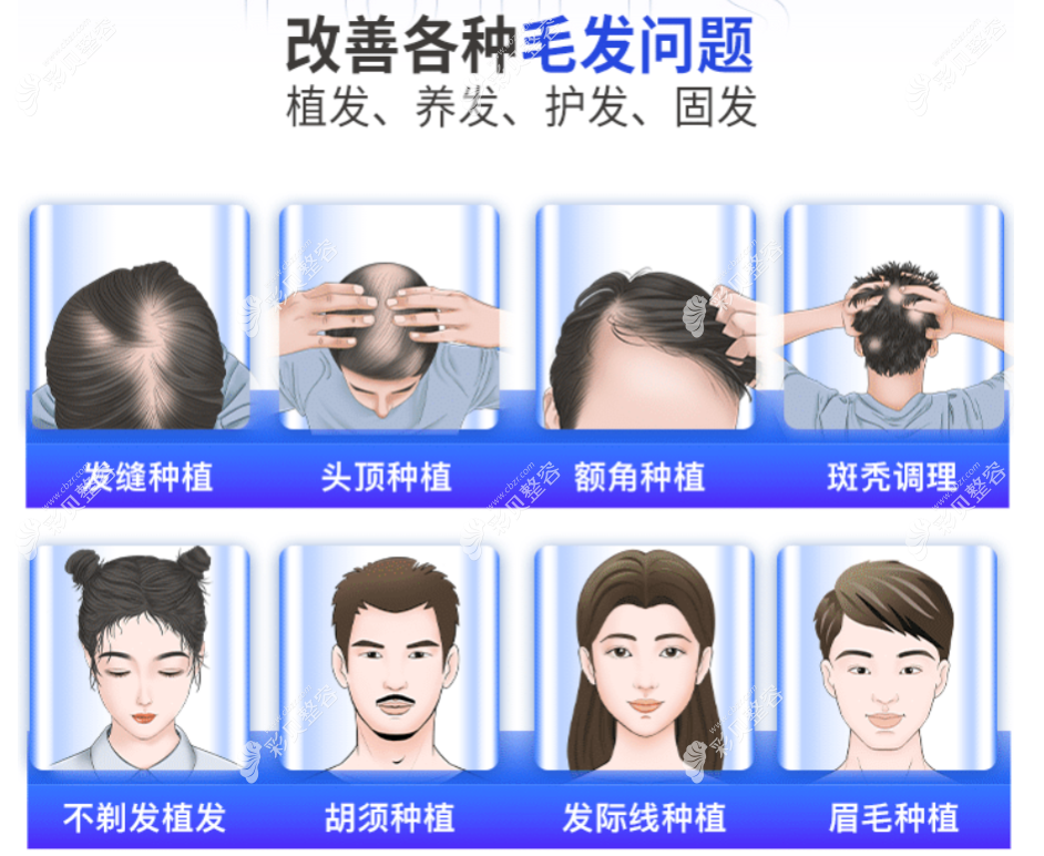 陈祖庆医生能做的毛发移植类项目