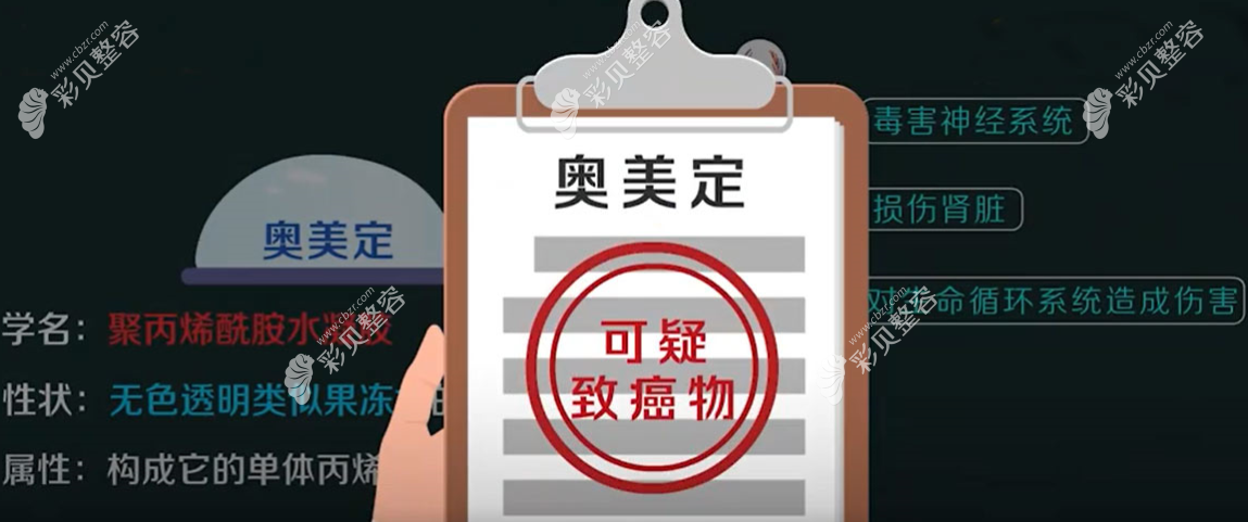 黄广香取奥美定技术怎么样