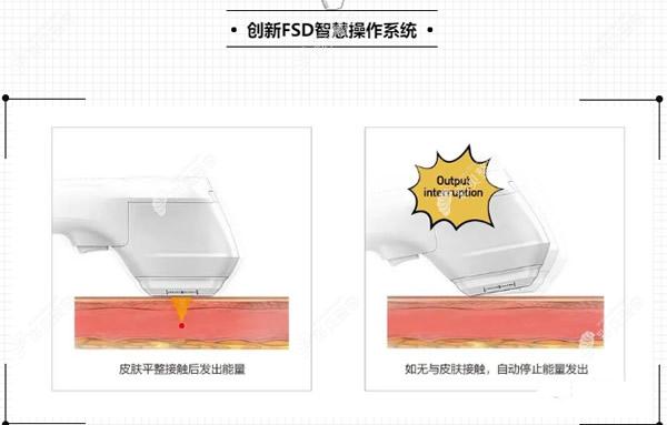 双逆博士比半岛超声炮更可靠、更放心