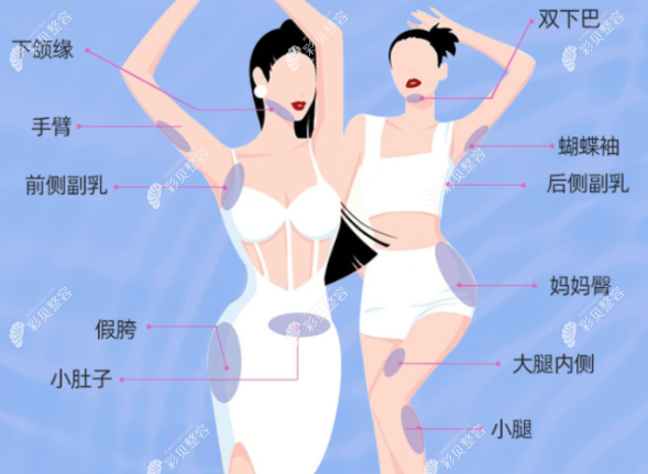 冯斌医生大腿腰腹吸脂亲身经历
