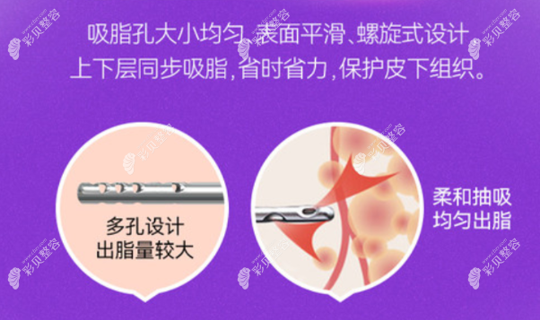 冯斌医生吸脂后不会出现凹凸不平