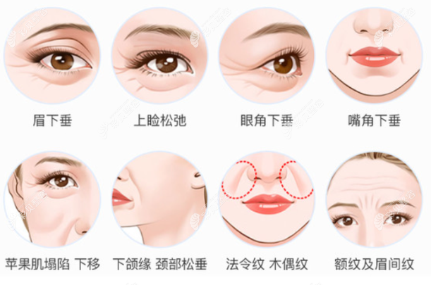 激光拉皮多少钱一次?热玛吉和超声炮等激光除皱价格区别大
