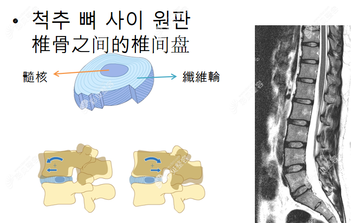 韩国李承哲神经外科医院治疗脊椎问题怎么样